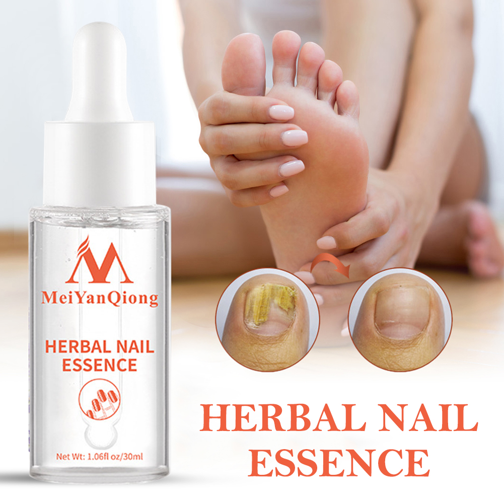 Foot Grooming Gel Anti  Nail W - Mens Grooming Treatment review and price
